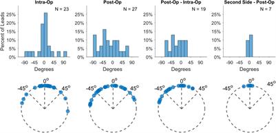 Local anatomy, stimulation site, and time alter directional deep brain stimulation impedances